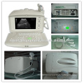 High quality Protable ultrasound machine Cheap ultrasound scanner come with abdominal probe MSLPU04M